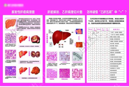 肝病科解剖图图片