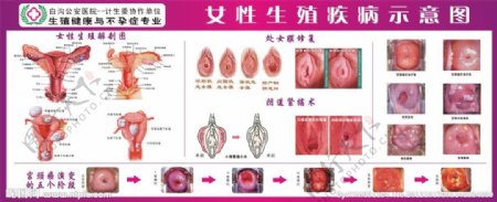 妇科解剖图谱生殖器整形图片
