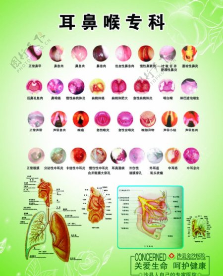 耳鼻喉圖片