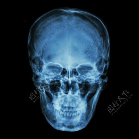 人的脸部X光片图片