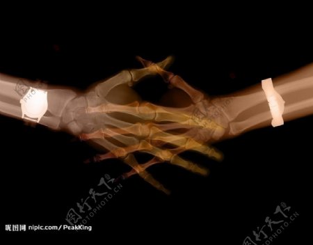 握手的X光照图片
