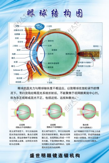 眼球结构图