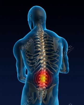 腰部关节疼痛图片