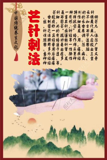 中华传统养生文化之芒针刺法