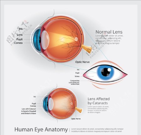 眼睛视网膜